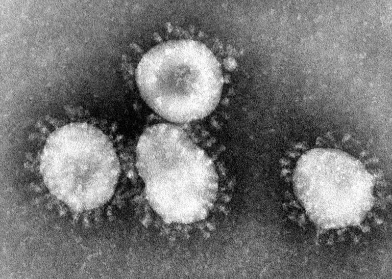 Coronavirus: oggi sono 17.750 i casi positivi